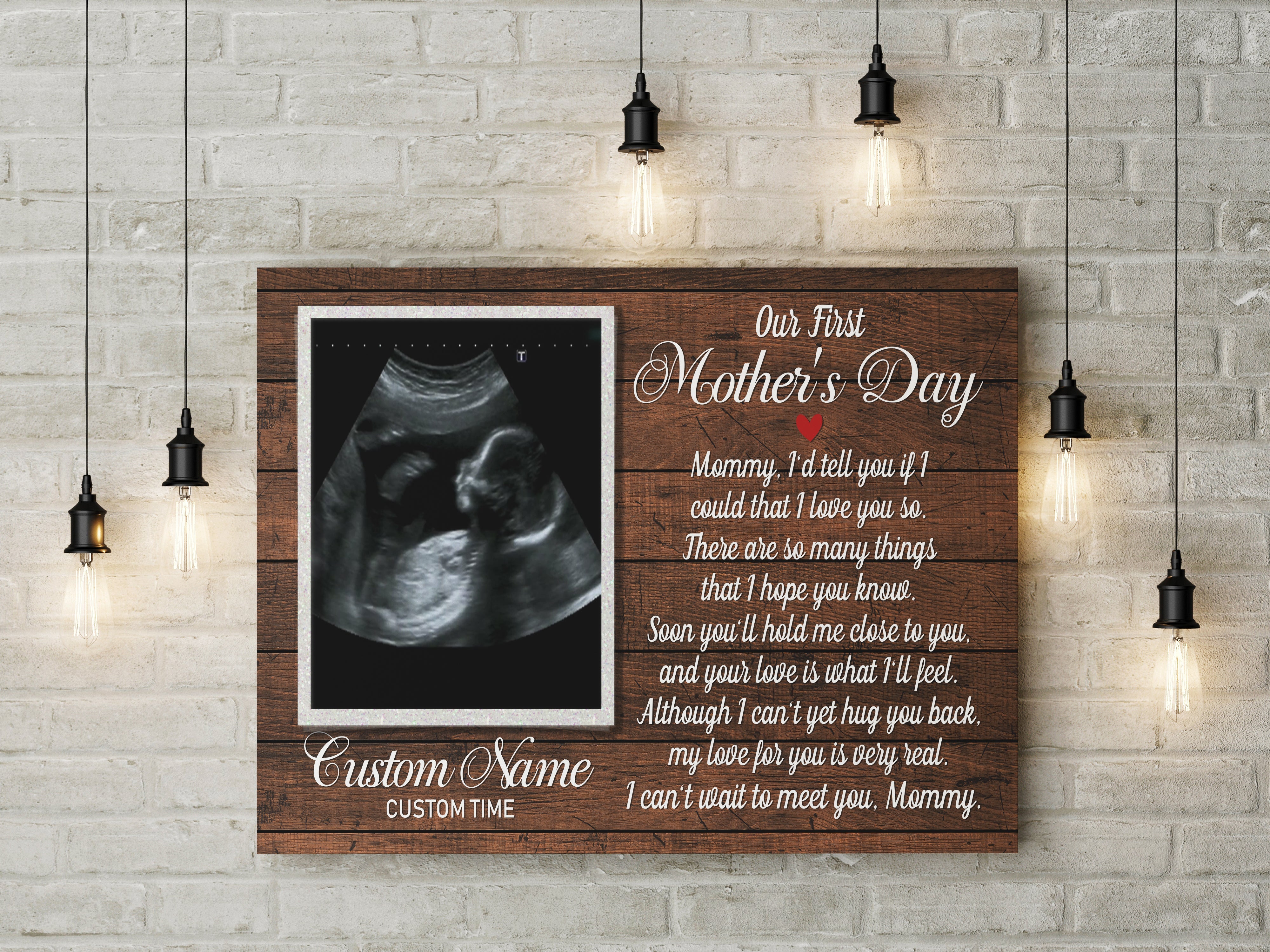 Personalized New Mom Canvas Can'T Wait To Meet You First Mother'S Day Gift For Wife, Expecting Mom, Custom Canvas Print